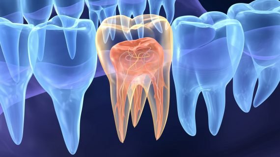 endodontia capa