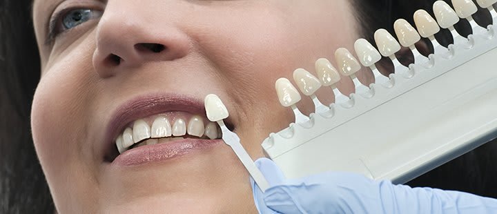 dentistica restauradora